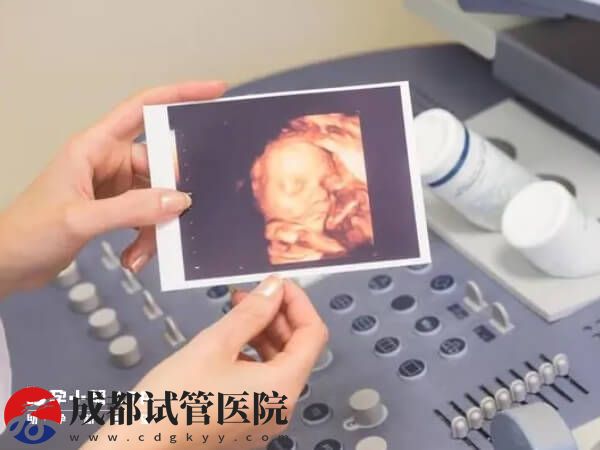 广东省妇幼保健院试管婴儿成功率预估，做到3点轻松好孕(图1)