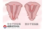 纵隔子宫的危害除了反复流产还有什么？